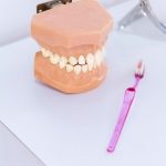 Белая стоматология: установка элайнеров в Казани